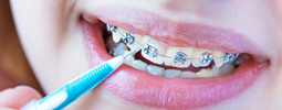 Brushing & Home Care