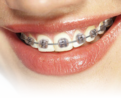 metal_thick