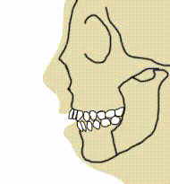 Orthognathic